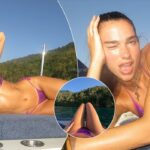 Ndryshimet në thonj që mund të tregojnë probleme shëndetësore